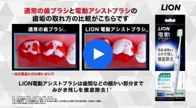 モーダルを開く